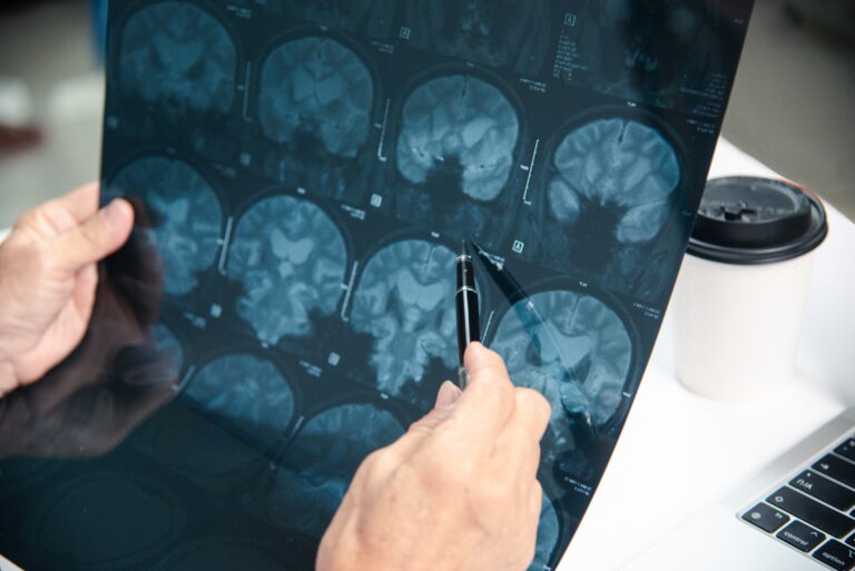 Doctor checking brain X-ray.