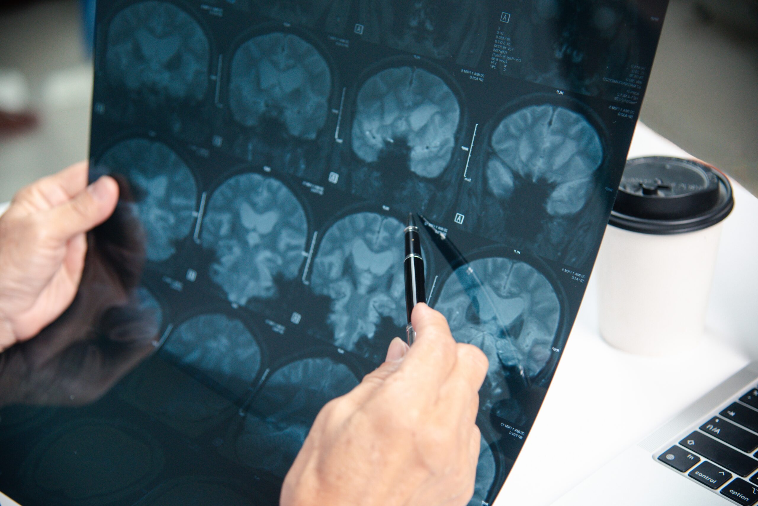 Doctor checking brain X-ray.