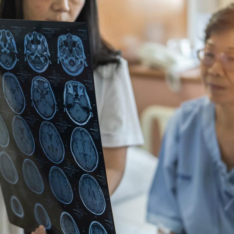 Brain disease diagnosis